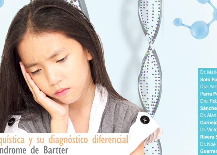 Fibrosis quística y su diagnóstico diferencial con el síndrome de Bartter