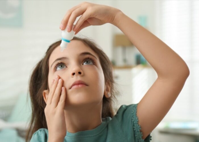 Alergia Ocular
