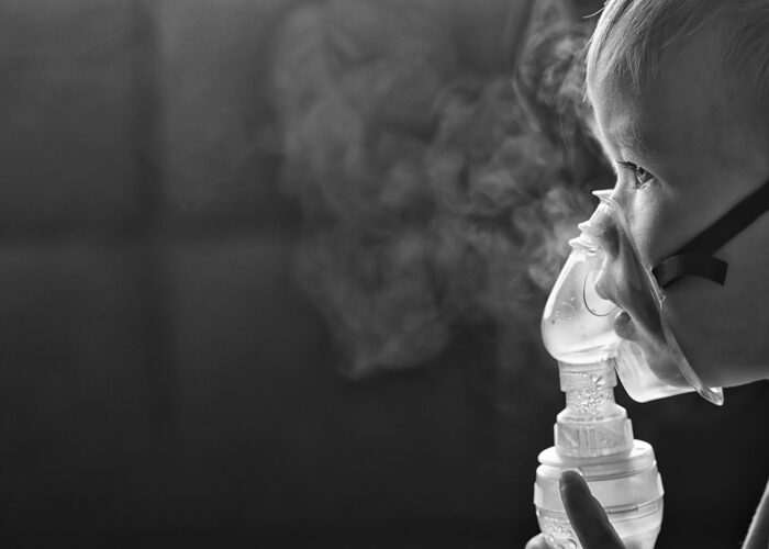 Asma en pediatría: una causa frecuente de sibilancias